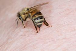 Spiritual Meaning of Being Stung by a Bee in Christianity