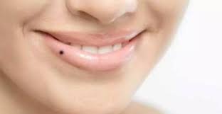 Meaning of mole on the lip